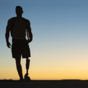 Amputation Injuries: Calculating Lifetime Costs and Damages in Kentucky