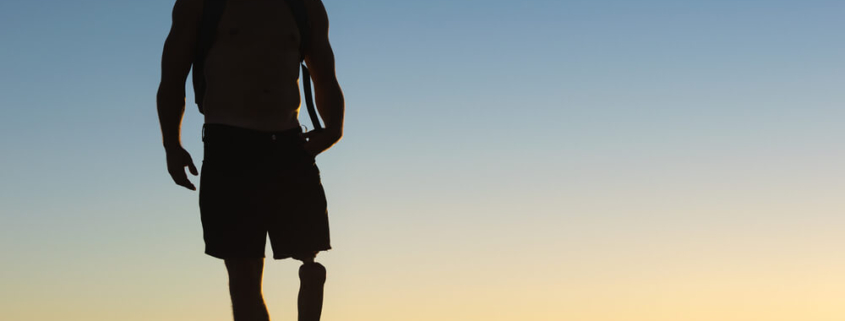 Amputation Injuries: Calculating Lifetime Costs and Damages in Kentucky